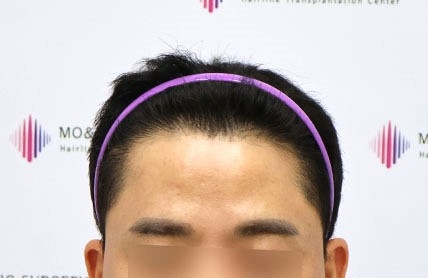 치료후기 이미지